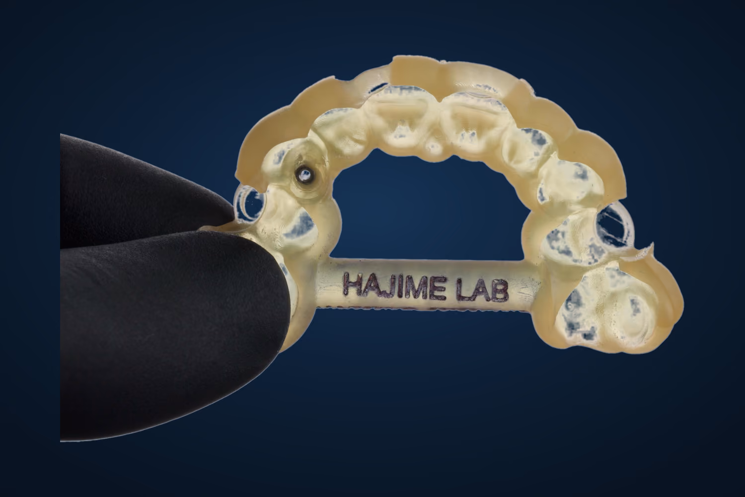Guia cirúrgica impressa em resina translúcida pelo Hajime Lab, com as luvas metálicas de perfuração e a gravação Hajime Lab na barra de reforço.