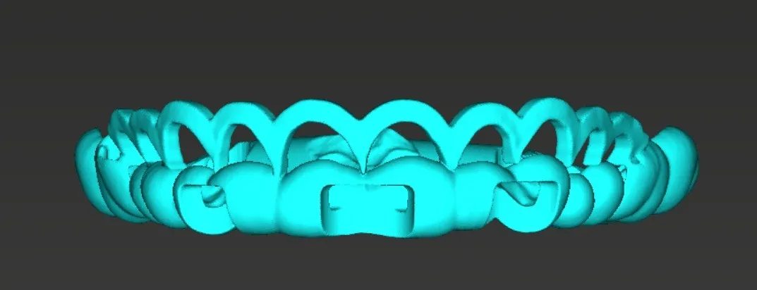 Guia periodontal em ciano vista de frente, com janelas recortadas sobre as faces vestibulares dos dentes anteriores e superfícies de apoio nos posteriores.