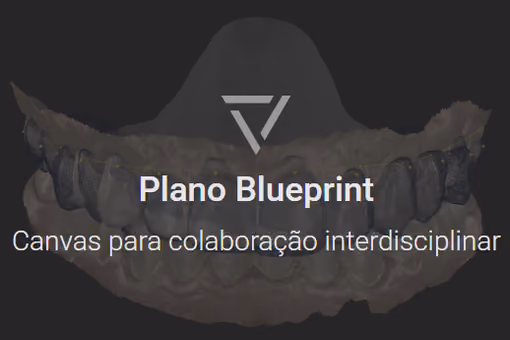Cartão Plano Blueprint na tela inicial do Smilecloud, com um modelo digital de arcada superior sobreposto a uma imagem tomográfica.